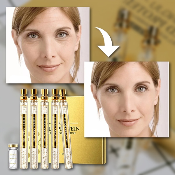 Set de seruri pentru îngrijirea proteică a pielii | PROLIFT