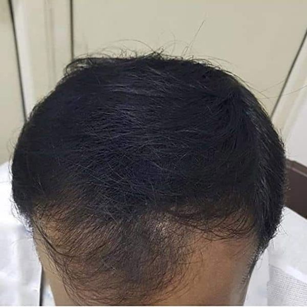 Spray cu microfibre pentru păr | HAIRBUILD